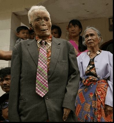 Grandpa dressed ready for a Ma'Nene ritual in Tana Toraja Indonesia. Used in the article Death and Dying in Torajan Culture. 